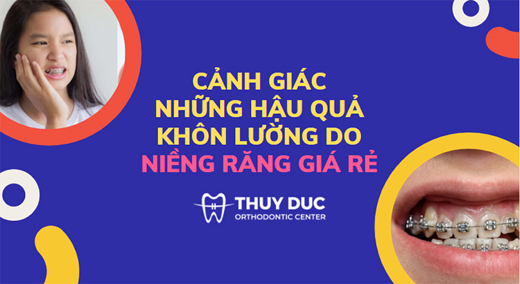 Cẩn thận với những hậu quả khôn lường do niềng răng giá rẻ 1