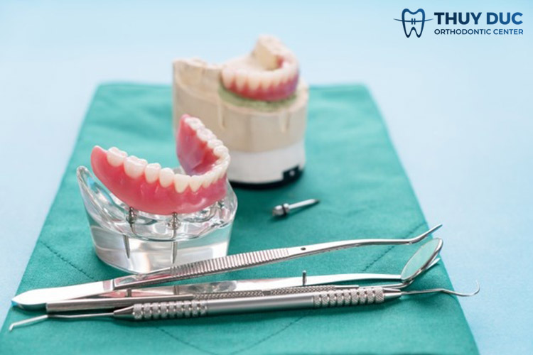 Trường hợp niềng răng hô cần nhổ 1 Trường hợp niềng răng hô cần nhổ 1
