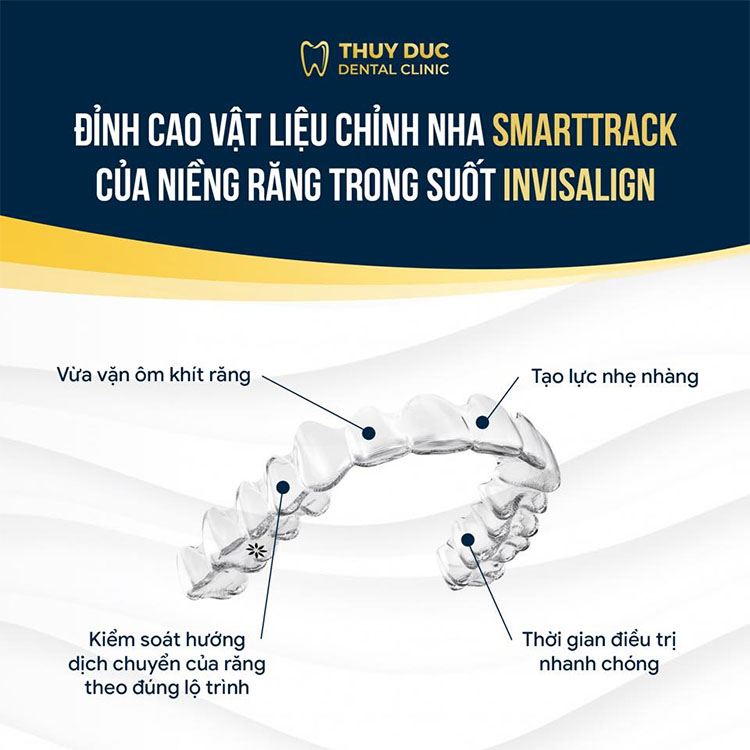 Các phương pháp niềng răng chữa miệng vẩu, răng hô hiệu quả 1 Các phương pháp niềng răng chữa miệng vẩu, răng hô hiệu quả 1