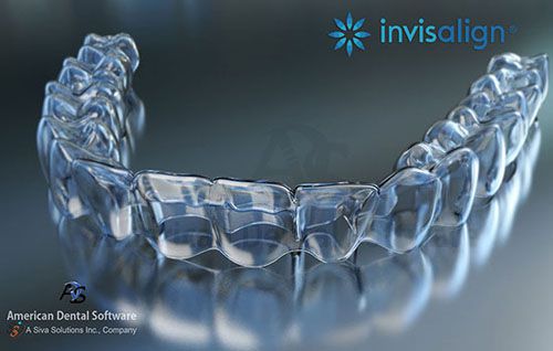 Niềng răng trong suốt Invisalign có phù hợp với trẻ em hay không? 1 Niềng răng trong suốt Invisalign có phù hợp với trẻ em hay không? 1