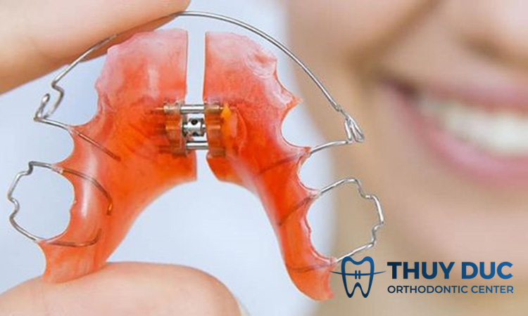 Nới rộng cung hàm 1 Nới rộng cung hàm 1