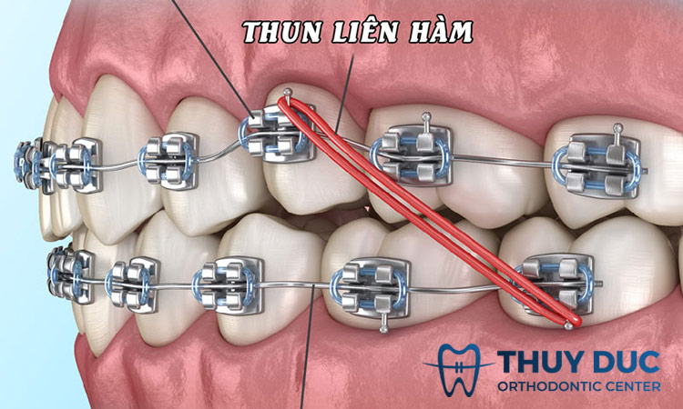 Thun liên hàm 1 Thun liên hàm 1