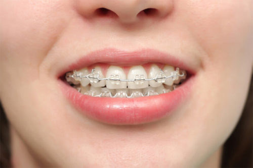 Người có tướng miệng vẩu cần phải làm gì để cải thiện vận mệnh của mình? 1 Người có tướng miệng vẩu cần phải làm gì để cải thiện vận mệnh của mình? 1