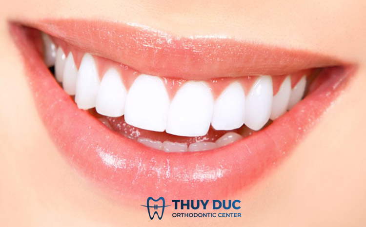 Quy trình bọc răng sứ cho răng thưa 1 Quy trình bọc răng sứ cho răng thưa 1