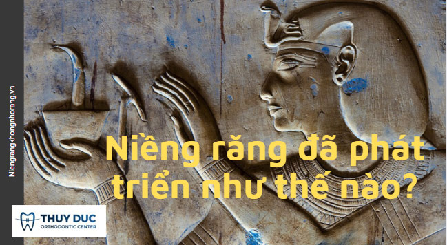 Niềng răng đã thay đổi thế nào trong những năm qua? 1 Niềng răng đã thay đổi thế nào trong những năm qua? 1
