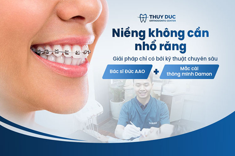 Phương pháp Niềng không nhổ răng F.A.C.E 1 Phương pháp Niềng không nhổ răng F.A.C.E 1