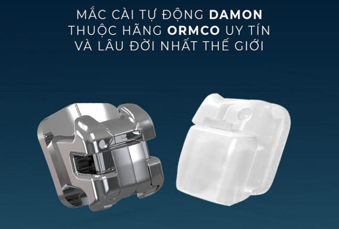 Tìm hiểu về mắc cài Damon Q2 1 Tìm hiểu về mắc cài Damon Q2 1
