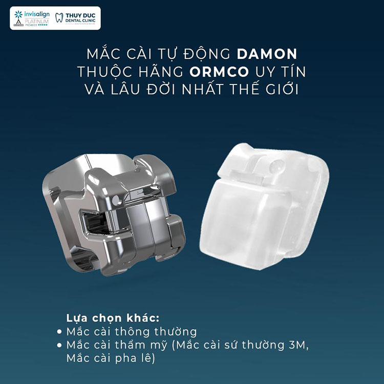 Các phương pháp niềng răng hiện đại tại Nha khoa Thúy Đức 2 Các phương pháp niềng răng hiện đại tại Nha khoa Thúy Đức 2