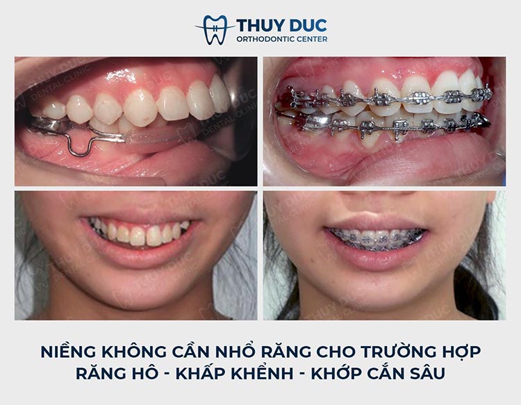 Bác sĩ Phạm Hồng Đức - chuyên gia chỉnh nha AAO 2 Bác sĩ Phạm Hồng Đức - chuyên gia chỉnh nha AAO 2