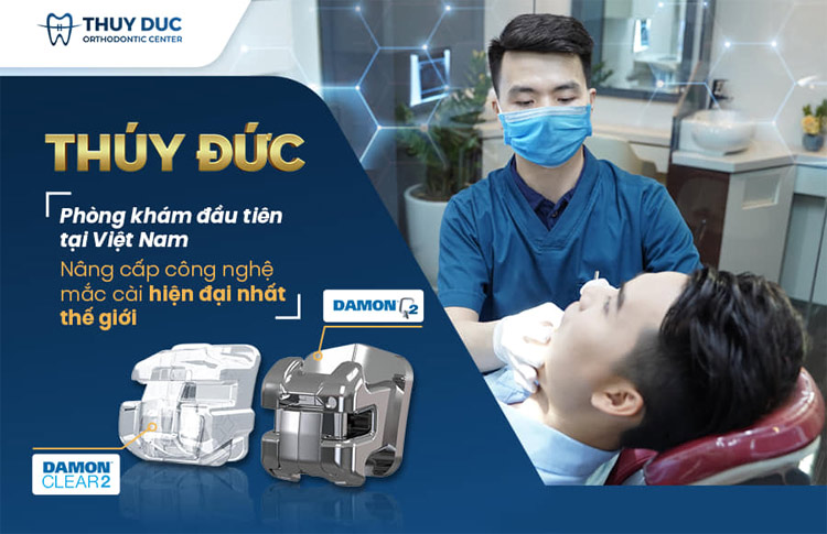 Vật liệu và thuốc men nào được sử dụng trong quá trình chỉnh nha? 1