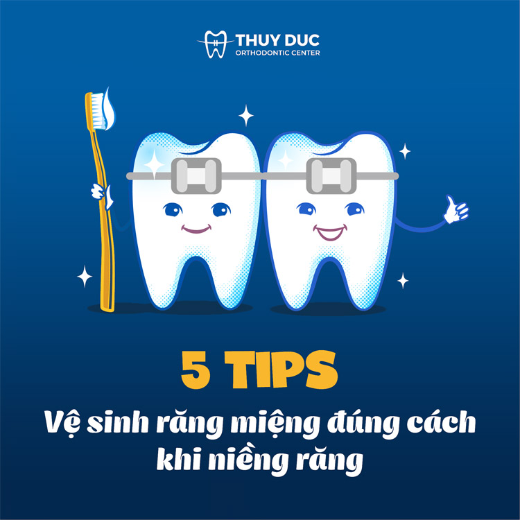 Chăm sóc răng miệng để thích thú với việc niềng răng 1 Chăm sóc răng miệng để thích thú với việc niềng răng 1