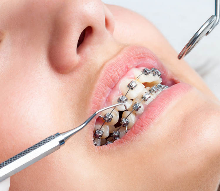 Mối liên hệ giữa chỉnh nha với sức khỏe răng miệng và sức khỏe tổng thể 1 Mối liên hệ giữa chỉnh nha với sức khỏe răng miệng và sức khỏe tổng thể 1