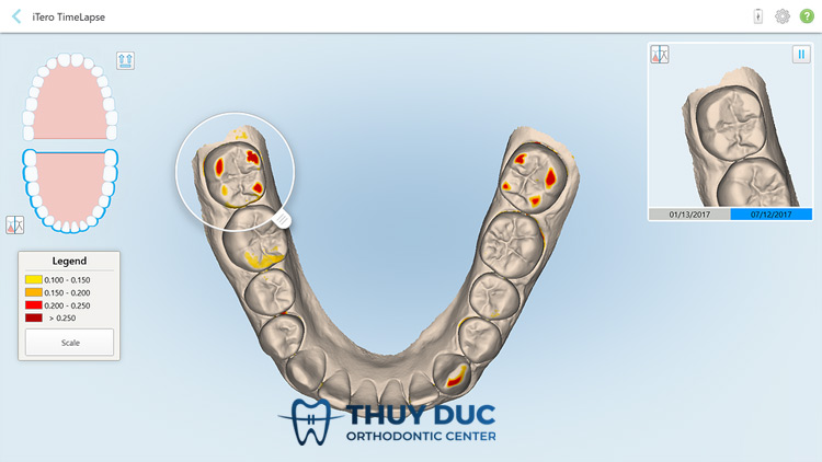 4. Dự báo sự cố với tính năng TimeLapse 1 4. Dự báo sự cố với tính năng TimeLapse 1