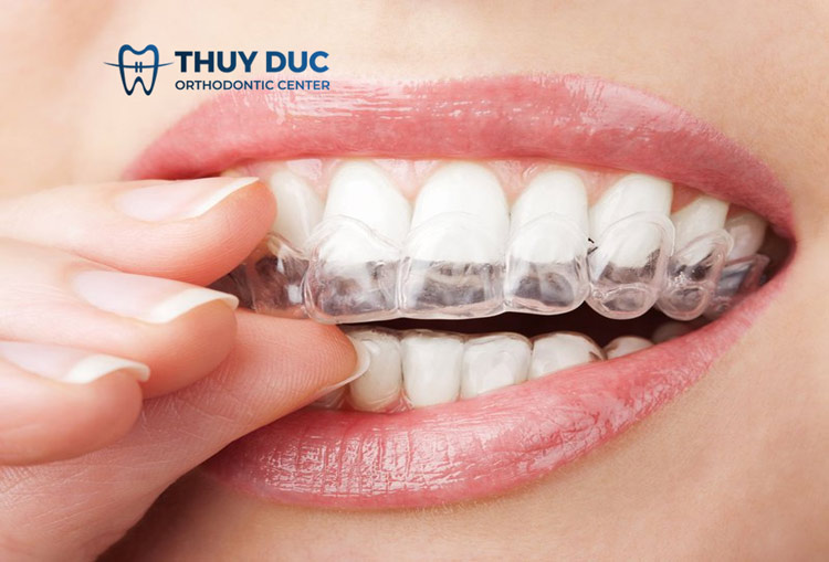 Đặc điểm của chất liệu SmartTrack 1 Đặc điểm của chất liệu SmartTrack 1