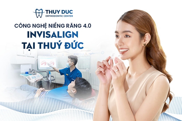 Điều trị răng cửa thưa bằng phương pháp niềng răng 2 Điều trị răng cửa thưa bằng phương pháp niềng răng 2