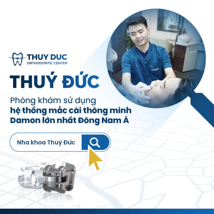 Niềng răng thưa ở đâu uy tín, hiệu quả? 1 Niềng răng thưa ở đâu uy tín, hiệu quả? 1