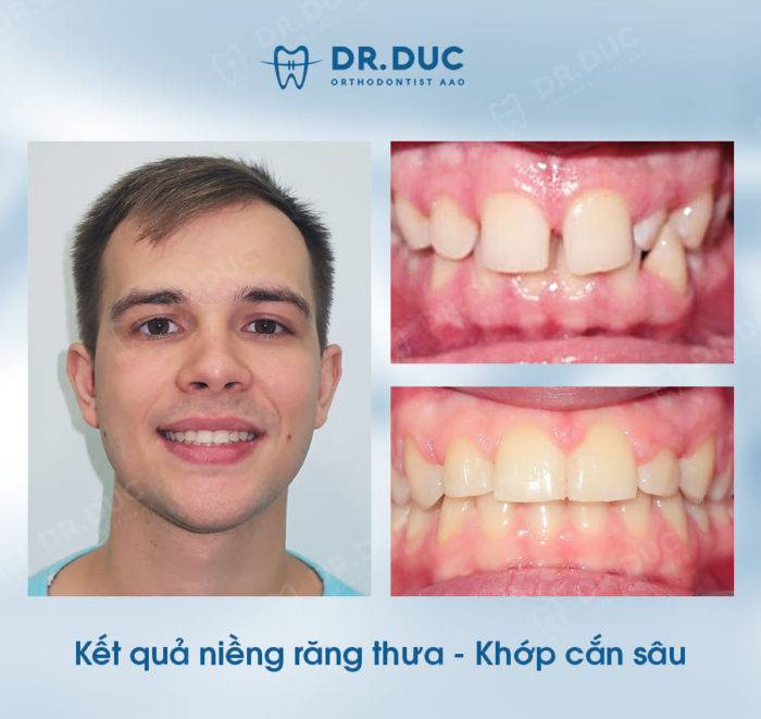 Chuyên gia chỉnh nha hàng đầu, bác sĩ Phạm Hồng Đức 2 Chuyên gia chỉnh nha hàng đầu, bác sĩ Phạm Hồng Đức 2