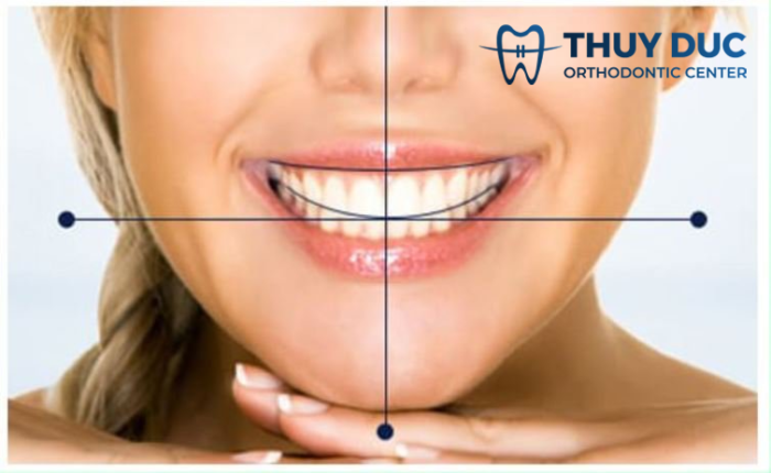 Thế nào là khớp cắn chuẩn? Tìm hiểu thông tin chi tiết 1 Thế nào là khớp cắn chuẩn? Tìm hiểu thông tin chi tiết 1