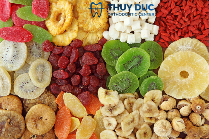 Những điều cần lưu ý khi thực hiện việc trám răng cửa thưa 1 Những điều cần lưu ý khi thực hiện việc trám răng cửa thưa 1