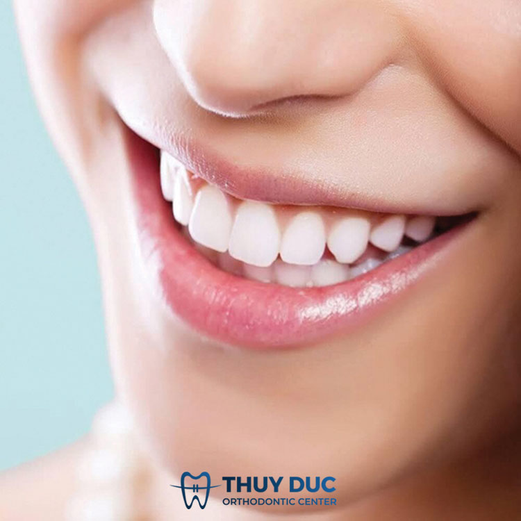 Bọc răng sứ 1 Bọc răng sứ 1