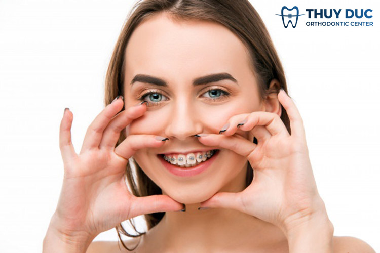 Niềng răng có khiến cho mũi cao hơn không? 1