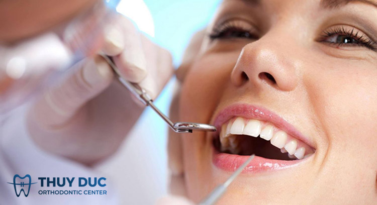 Mài kẽ răng khi niềng răng là gì? 1