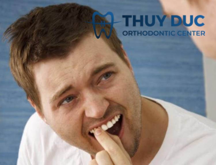 Trường hợp răng cửa lung lay khi niềng là bình thường 1 Trường hợp răng cửa lung lay khi niềng là bình thường 1