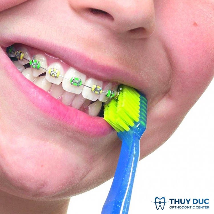 Cách chăm sóc răng miệng mỗi ngày 1 Cách chăm sóc răng miệng mỗi ngày 1