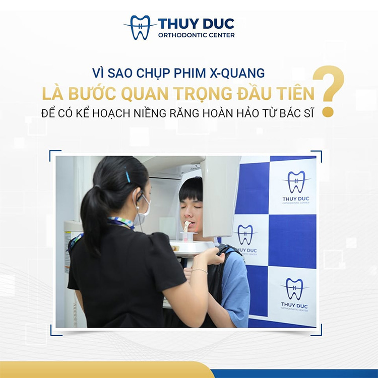 Chụp X - quang răng là gì? Tại sao cần chụp X - quang khi niềng? 1 Chụp X - quang răng là gì? Tại sao cần chụp X - quang khi niềng? 1