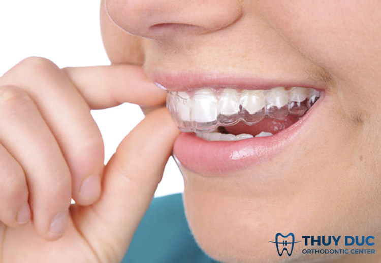 Rối loạn khớp thái dương hàm chữa bằng cách nào? 1 Rối loạn khớp thái dương hàm chữa bằng cách nào? 1