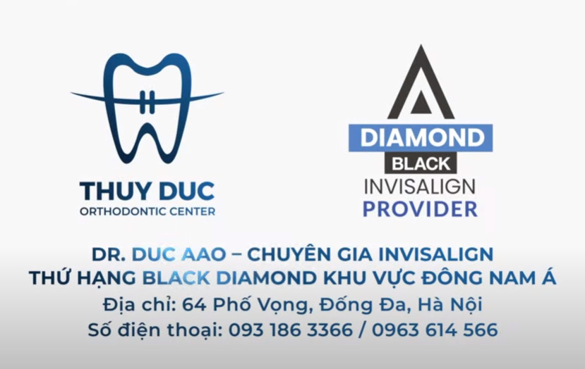 Làm cầu răng sứ có niềng răng được không? 2 Làm cầu răng sứ có niềng răng được không? 2