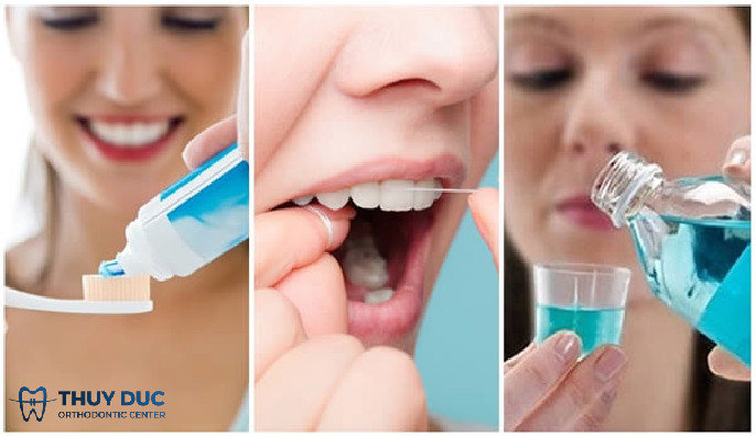 Vệ sinh răng miệng cẩn thận 1