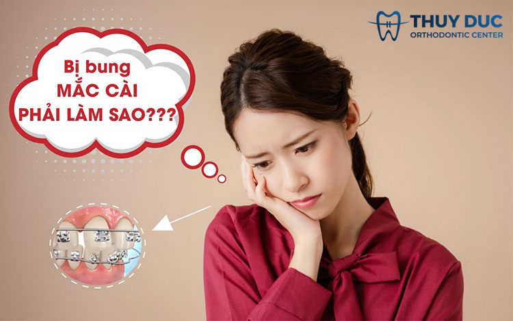 Cách xử lý mắc cài bị tuột nhanh nhất 1 Cách xử lý mắc cài bị tuột nhanh nhất 1
