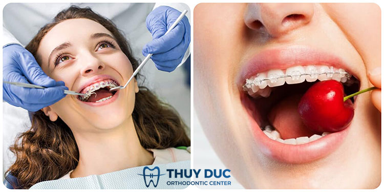 Nguyên nhân khiến cho bị dây cung đâm vào má 1 Nguyên nhân khiến cho bị dây cung đâm vào má 1