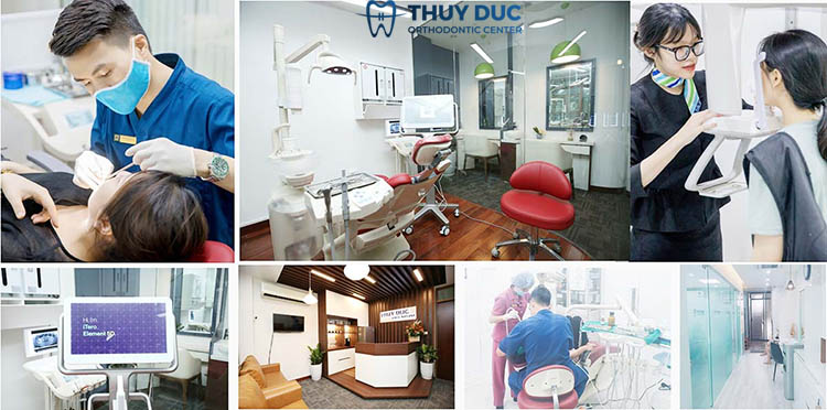 Cách phòng chống dây cung đâm vào má 1 Cách phòng chống dây cung đâm vào má 1