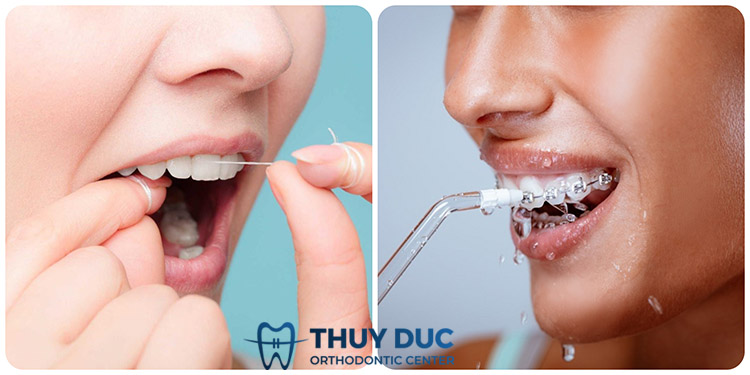 Nên dùng cách nào thay thế cho tăm xỉa răng? 1