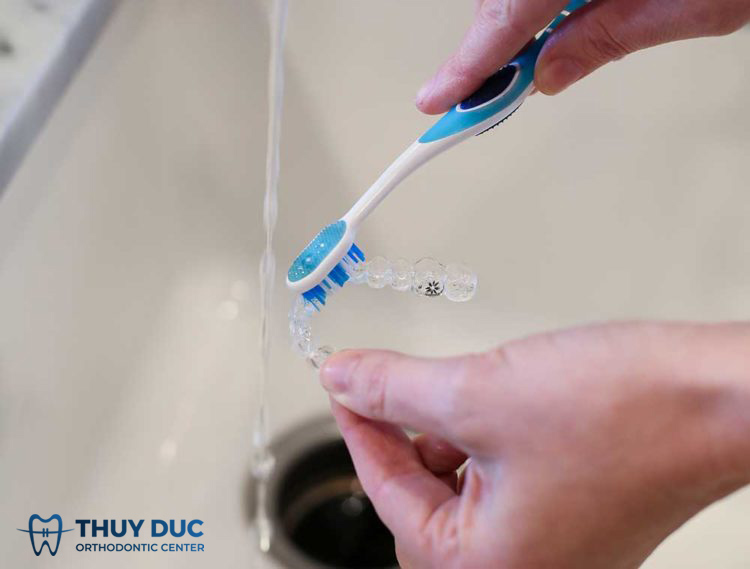 Một số điều cần nhớ khi đeo hàm duy trì 1 Một số điều cần nhớ khi đeo hàm duy trì 1
