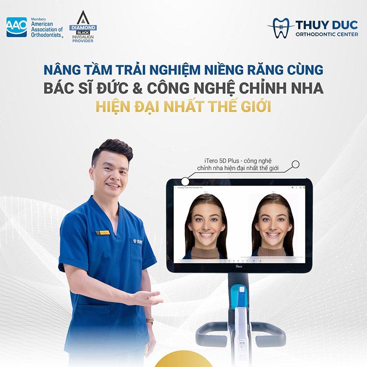 Những điều cần biết về máy quét dấu răng Itero element 5D Plus 1 Những điều cần biết về máy quét dấu răng Itero element 5D Plus 1