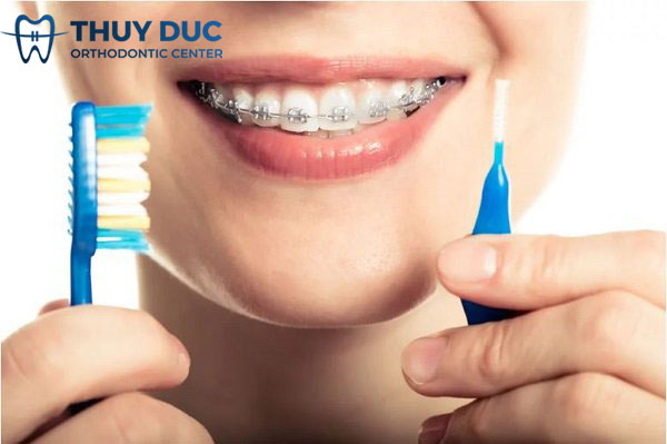 Kinh nghiệm chăm sóc răng miệng khi mới niềng 2 Kinh nghiệm chăm sóc răng miệng khi mới niềng 2