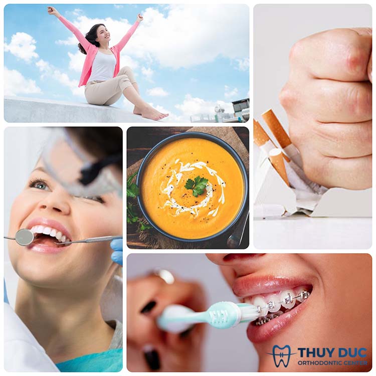 Những lưu ý khi niềng răng trong thời gian nghiến răng 1