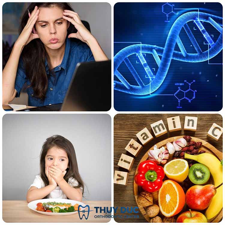 Các nguyên nhân chính gây ra tật nghiến răng 1