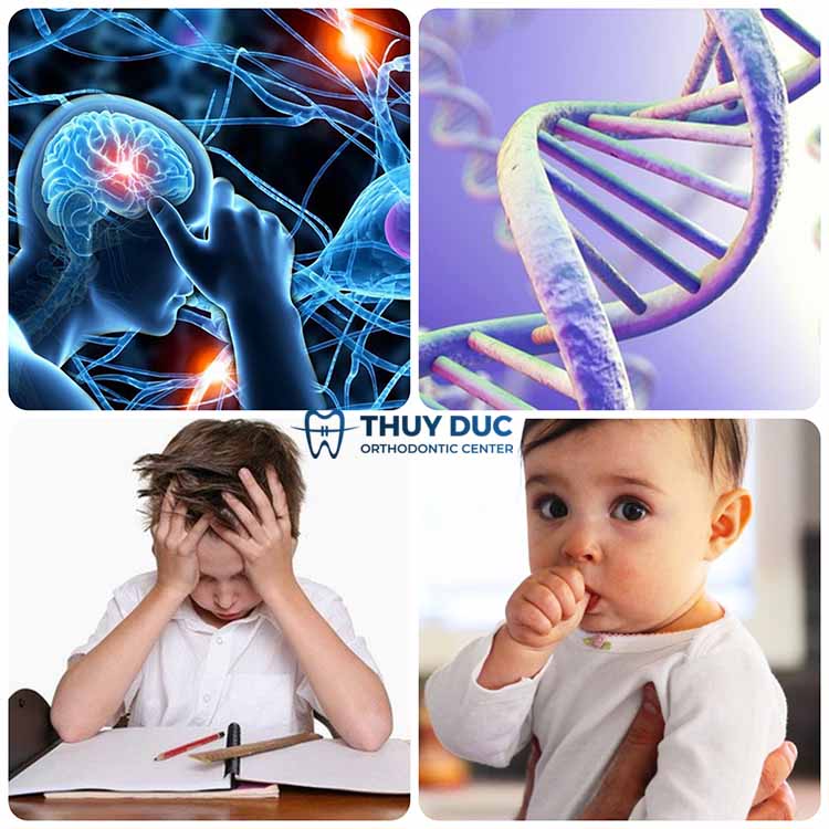 Những nguyên nhân chính gây ra tật đẩy lưỡi 1 Những nguyên nhân chính gây ra tật đẩy lưỡi 1