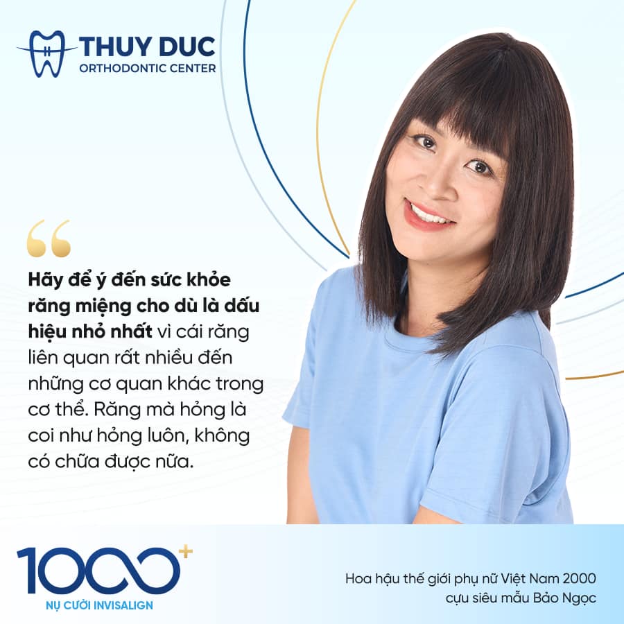 CHUYỆN BÂY GIỜ MỚI KỂ VỀ NỤ CƯỜI INVISALIGN ĐẦU TIÊN 3