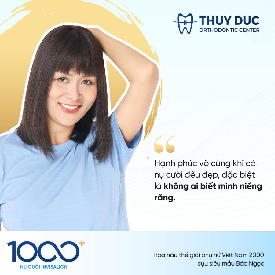 CHUYỆN BÂY GIỜ MỚI KỂ VỀ NỤ CƯỜI INVISALIGN ĐẦU TIÊN 4