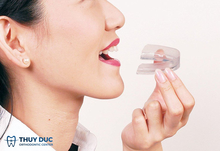 Hướng dẫn sử dụng máng chống nghiến răng hiệu quả 1
