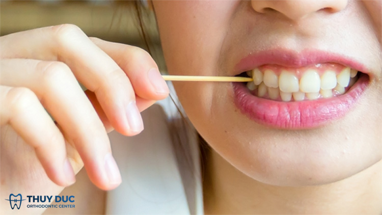 Tại sao xỉa răng bị thưa răng là cách quan trọng để bảo vệ răng miệng của bạn