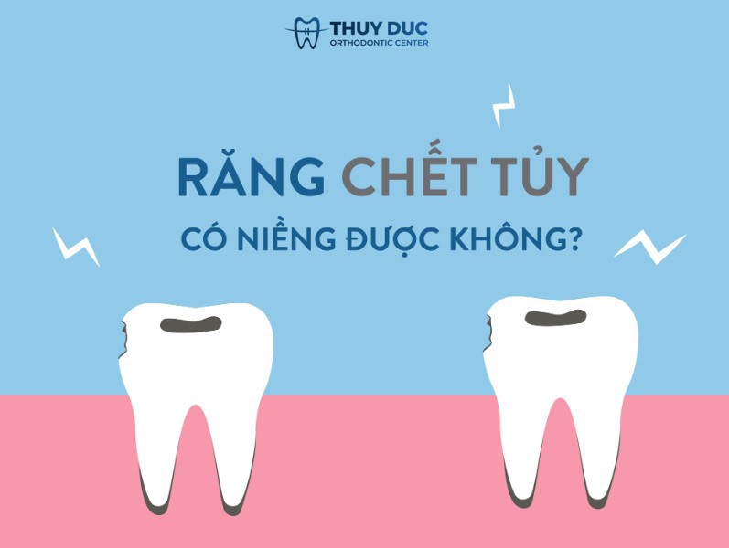 Răng đã lấy tủy có niềng được không? 1