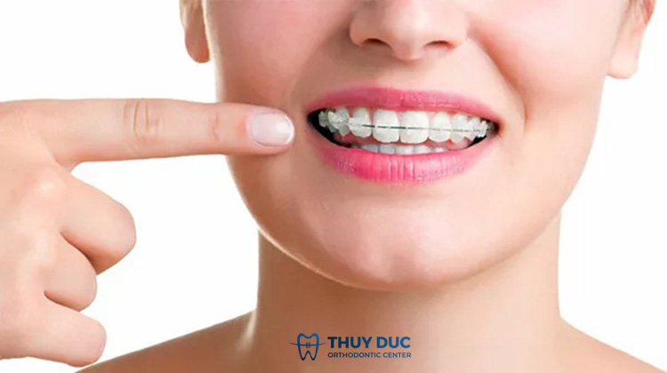 Mách bạn cách để sở hữu nụ cười đẹp 1 Mách bạn cách để sở hữu nụ cười đẹp 1
