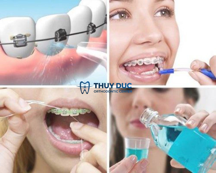 Cách chăm sóc răng miệng 1