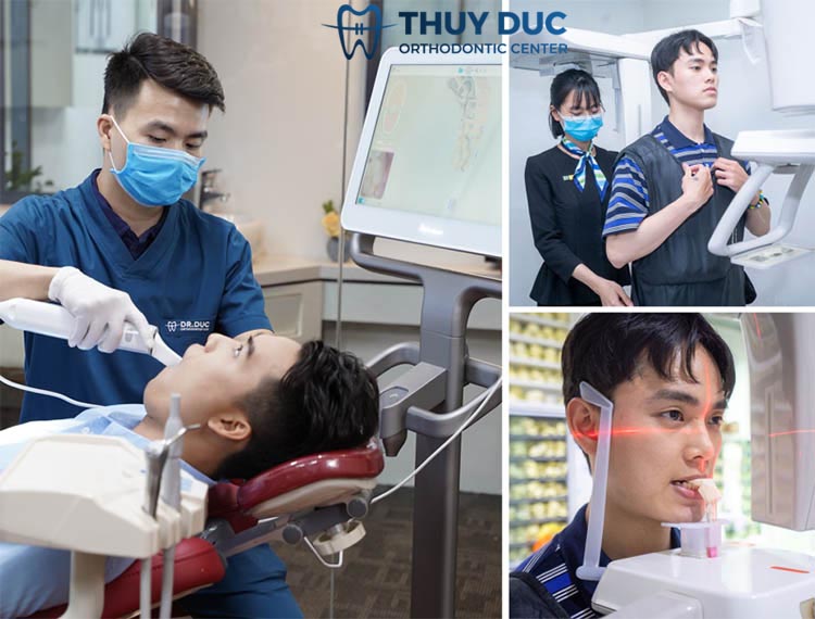 Địa chỉ khắc phục cười hở lợi uy tín nhất 1